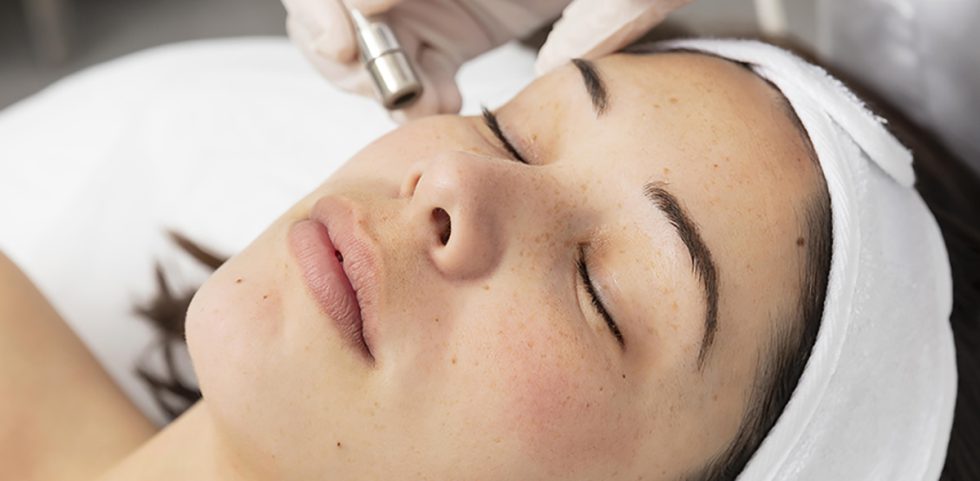 Melasma Treatment Dr Rozina Asif Skin & Laser Cosmetics Clinic Mardan