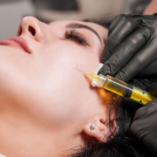 PRP PRF Dr Rozina Asif Skin & Laser Cosmetics Clinic Mardan